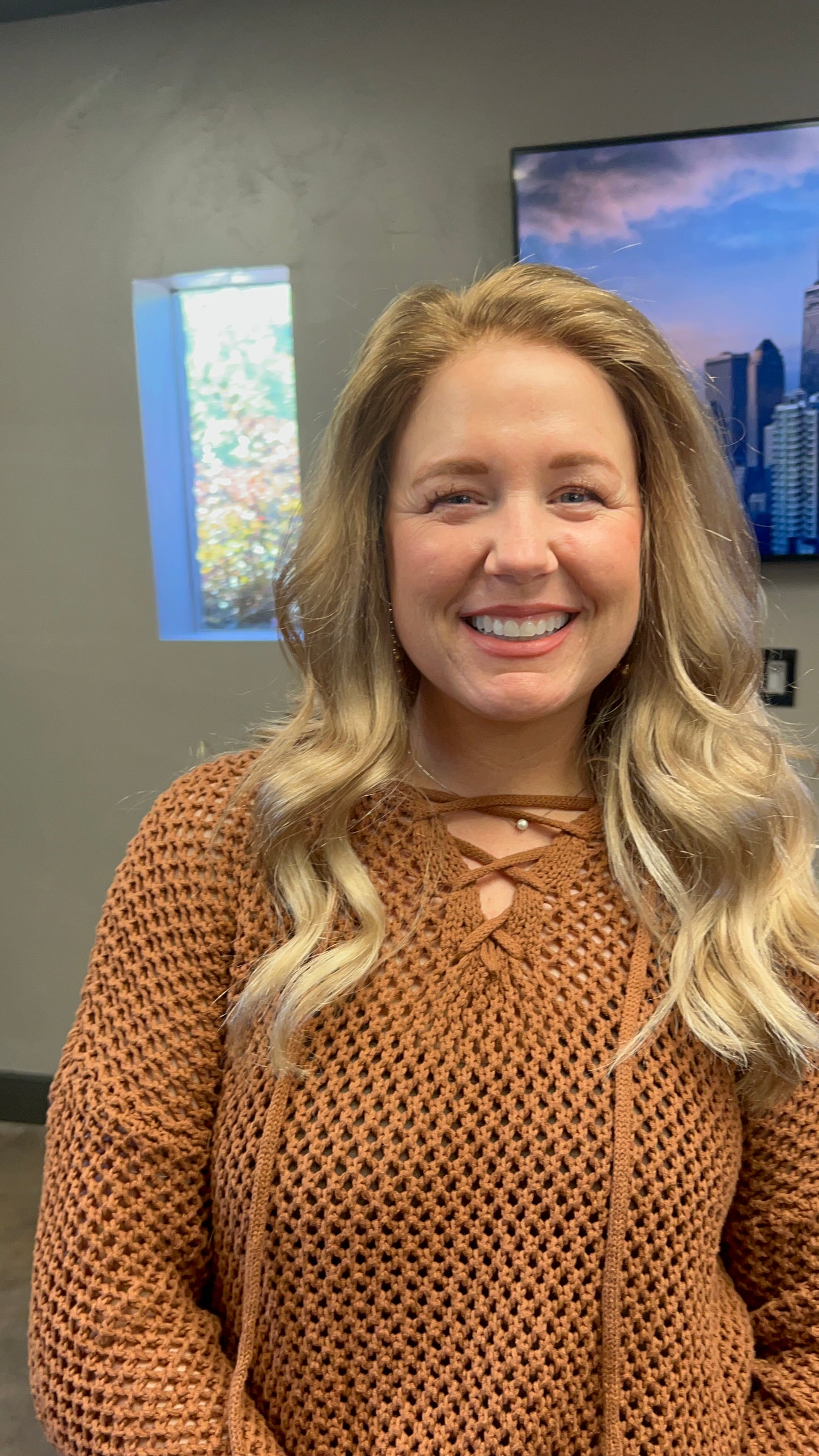 JESSICA- Cranial Prothesis